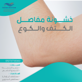 خشونة مفاصل الكتف والكوع