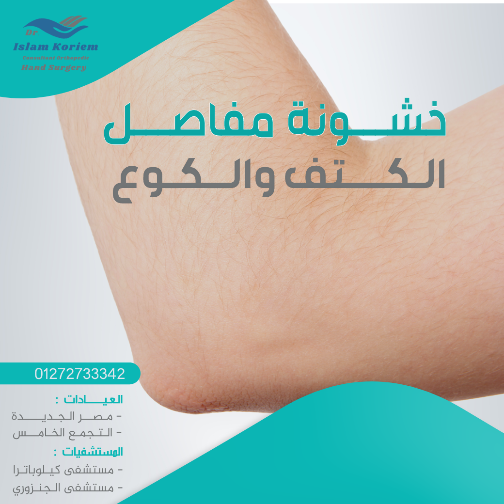 خشونة-مفاصل-الكتف-والكوع.png